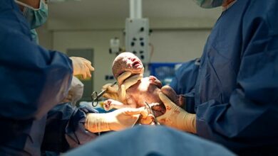 النفاس بعد الولادة القيصرية